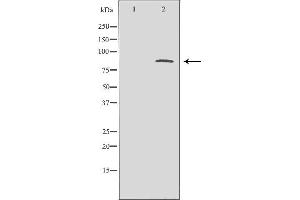 Western blot analysis of brain  lysate usingCTCF antibody. (CTCF Antikörper  (C-Term))