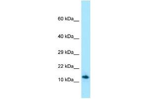 Western Blotting (WB) image for anti-Shadow of Prion Protein (SPRN) (C-Term) antibody (ABIN2789981) (SPRN Antikörper  (C-Term))