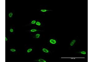 Immunofluorescence of monoclonal antibody to FOXP2 on HeLa cell. (FOXP2 Antikörper  (AA 616-715))