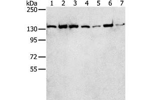 Western Blot analysis of Hepg2, MCF7, Jurkat, hela, A431, K562 and lncap cell using SMARCA5 Polyclonal Antibody at dilution of 1:250 (SMARCA5 Antikörper)
