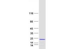 Western Blotting (WB) image for High Mobility Group AT-Hook 1 (HMGA1) (Transcript Variant 2) protein (Myc-DYKDDDDK Tag) (ABIN2722866)