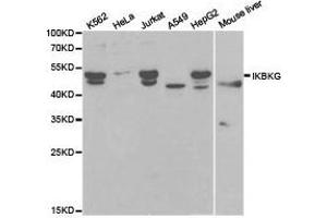 Western Blotting (WB) image for anti-Inhibitor of kappa Light Polypeptide Gene Enhancer in B-Cells, Kinase gamma (IKBKG) antibody (ABIN1873181) (IKBKG Antikörper)