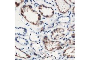 Immunohistochemical analysis of MOB3C staining in human kidney formalin fixed paraffin embedded tissue section. (MOBKL2C Antikörper)