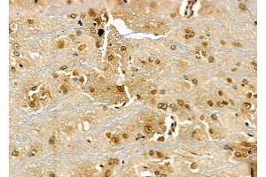 ABIN6266313 and ABIN6277430 at 1/100 staining Rat brain tissue by IHC-P. (RAD52 Antikörper  (Internal Region))