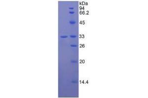 SDS-PAGE analysis of Human Jagged 2 Protein. (JAG2 Protein)