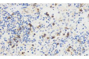 Immunohistochemistry analysis of paraffin-embedded mouse spleen using THY1 Polyclonal Antibody at dilution of 1:500. (CD90 Antikörper)