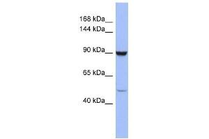 ZFP28 antibody used at 0. (ZFP28 Antikörper  (Middle Region))