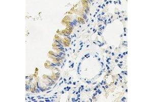 Immunohistochemical analysis of RANBP5 staining in mouse lung formalin fixed paraffin embedded tissue section. (Importin 5 Antikörper)