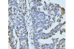 IHC analysis of ARL6IP6 using anti-ARL6IP6 antibody (ABIN7603020). (ARL6IP6 Antikörper  (Middle Region))