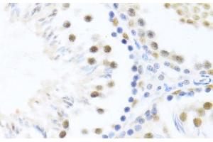 Immunohistochemistry of paraffin-embedded Rat testis using DDX46 Polyclonal Antibody at dilution of 1:100 (40x lens). (DDX46 Antikörper)