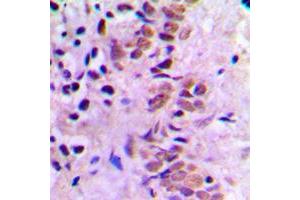 Immunohistochemistry (IHC) image for anti-E2F Transcription Factor 1 (E2F1) (C-Term) antibody (ABIN7300626)