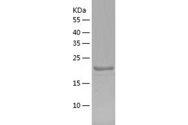 GCET2 Protein (AA 1-178) (His tag)