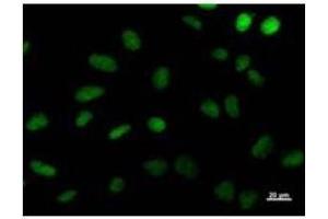 Immunostaining analysis in HeLa cells. (DDB2 Antikörper)