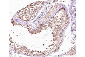 ABIN6266658 at 1/100 staining human testis tissue sections by IHC-P.