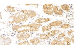 Detection of CDKN1A in Human Stomach Tissue using Polyclonal Antibody to Cyclin Dependent Kinase Inhibitor 1A (CDKN1A) (p21 Antikörper  (AA 1-164))