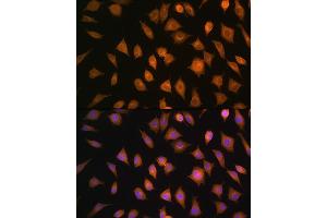 Immunofluorescence analysis of L929 cells using ELOVL4 Rabbit pAb (ABIN1679709, ABIN3017923, ABIN3017924 and ABIN6220305) at dilution of 1:100. (ELOVL4 Antikörper  (AA 1-100))