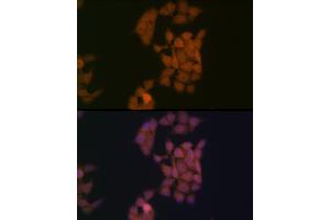 Immunofluorescence analysis of HeLa cells using Kaiso/ZBTB33 Rabbit mAb (ABIN7271437) at dilution of 1:100 (40x lens). (ZBTB33 Antikörper)