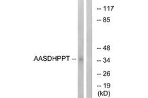 Western blot analysis of extracts from COLO cells, using AASDHPPT Antibody. (AASDHPPT Antikörper  (AA 11-60))