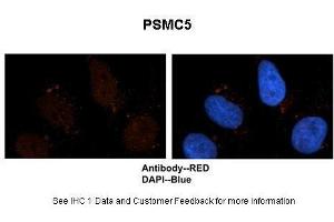 Sample Type :  Human brain stem cells  Primary Antibody Dilution :  1:500  Secondary Antibody :  Goat anti-rabbit Alexa-Fluor 594  Secondary Antibody Dilution :  1:1000  Color/Signal Descriptions :  PSMC5: Red DAPI:Blue  Gene Name :  PSMC5  Submitted by :  Dr. (PSMC5 Antikörper  (C-Term))