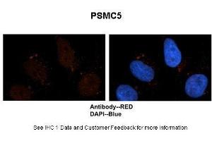 Sample Type :  Human brain stem cells  Primary Antibody Dilution :  1:500  Secondary Antibody :  Goat anti-rabbit Alexa-Fluor 594  Secondary Antibody Dilution :  1:1000  Color/Signal Descriptions :  PSMC5: Red DAPI:Blue  Gene Name :  PSMC5  Submitted by :  Dr.