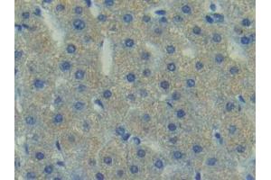 Immunohistochemistry (IHC) image for anti-PTK2 Protein tyrosine Kinase 2 (PTK2) (AA 798-1041) antibody (ABIN7439699)