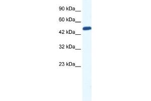 WB Suggested Anti-ZNF239 Antibody Titration:  0. (ZNF239 Antikörper  (N-Term))