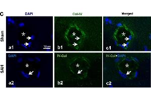 The molecules involved in IPAD impairment after SAH. (COL4a3 Antikörper  (AA 1571-1670))