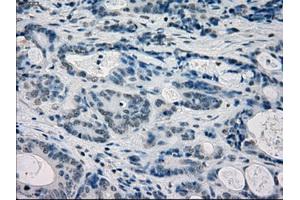 Immunohistochemical staining of paraffin-embedded endometrium tissue using anti-FRKmouse monoclonal antibody. (FRK Antikörper)