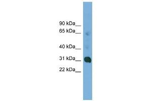 CCDC127 antibody used at 1 ug/ml to detect target protein. (CCDC127 Antikörper  (N-Term))