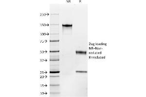 SDS-PAGE Analysis Purified CD117 Mouse Monoclonal Antibody (C117/370). (KIT Antikörper)