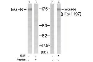 Image no. 1 for anti-Epidermal Growth Factor Receptor (EGFR) (Tyr1197) antibody (ABIN197463) (EGFR Antikörper  (Tyr1197))