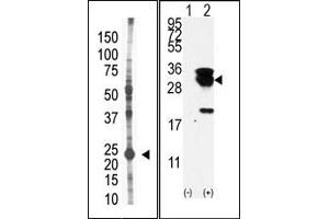 Image no. 1 for anti-Ubiquitin-Conjugating Enzyme E2S (UBE2S) (N-Term) antibody (ABIN357497) (UBE2S Antikörper  (N-Term))