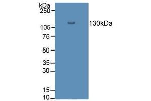 Detection of DSG3 in Porcine Skin Tissue using Polyclonal Antibody to Desmoglein 3 (DSG3) (Desmoglein 3 Antikörper  (AA 858-999))