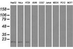 Western blot analysis of extracts (35 µg) from 9 different cell lines by using anti-CTAG1B monoclonal antibody. (CTAG1B Antikörper)