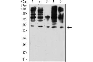 Western Blotting (WB) image for anti-Wilms Tumor 1 (WT1) (AA 1-181) antibody (ABIN7193597)