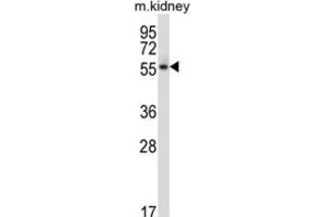 Western Blotting (WB) image for anti-Polo-Like Kinase 5 (PLK5) antibody (ABIN2997865) (PLK5 Antikörper)