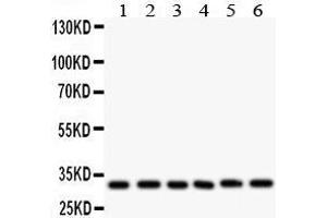 Anti- CASP3 antibody, Western blotting All lanes: Anti CASP3  at 0. (Caspase 3 Antikörper  (C-Term))
