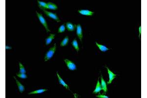 Immunofluorescent analysis of Hela cells using ABIN7156472 at dilution of 1: 100 and Alexa Fluor 488-congugated AffiniPure Goat Anti-Rabbit IgG(H+L) (CD11c Antikörper  (AA 100-350))