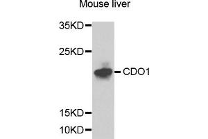 Western blot analysis of extracts of mouse liver cells, using CDO1 antibody. (CDO1 Antikörper)