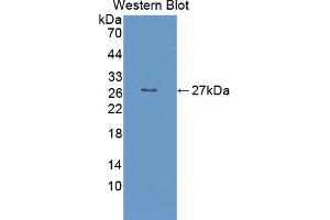 Western blot analysis of the recombinant protein. (EBI3 Antikörper  (AA 19-228))