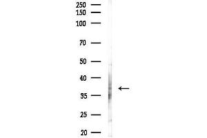Western blot analysis of lysates from HUVEC cells(LPS, 4h treatment), using P2RY12 Antibody at 1/1000 dilution.