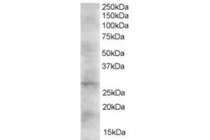 Western Blotting (WB) image for anti-Dickkopf 2 Homolog (DKK2) (C-Term) antibody (ABIN2465604) (DKK2 Antikörper  (C-Term))