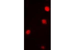 Immunofluorescent analysis of Ataxin 3 staining in Jurkat cells. (Ataxin 3 Antikörper)