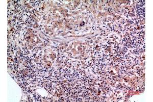 Immunohistochemistry (IHC) analysis of paraffin-embedded Human Lung, antibody was diluted at 1:100. (SCCA1/2 (Internal Region) Antikörper)