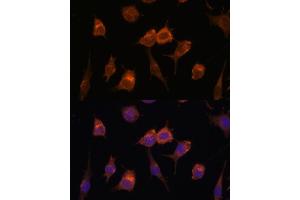 Immunofluorescence analysis of L929 cells using AVIL antibody (ABIN7265508) at dilution of 1:100. (Advillin Antikörper  (AA 470-819))
