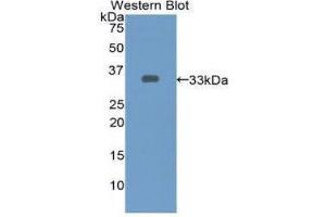 Western Blotting (WB) image for anti-Endothelin-Converting Enzyme 1 (ECE1) (AA 469-721) antibody (ABIN1858682)