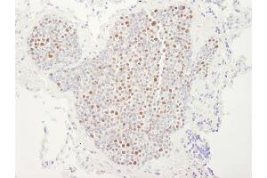 Immunohistochemistry (IHC) image for anti-Minichromosome Maintenance Deficient 4 (MCM4) (AA 750-800) antibody (ABIN7448654)