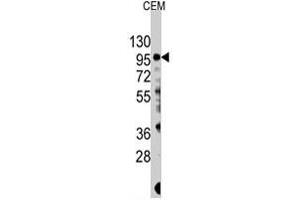 Western blot analysis of PIK3CG polyclonal antibody  in CEM cell lysate (35 ug/lane). (PIK3 gamma Antikörper  (Ser1100))