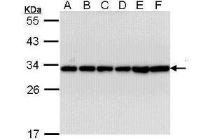 WB Image Sample (30 ug of whole cell lysate) A: A431 , B: H1299 C: Hela D: Hep G2 , E: Molt-4 , F: Raji 12% SDS PAGE antibody diluted at 1:10000