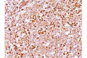 Formalin-fixed, paraffin-embedded human Tonsil stained with CD79a Rabbit Recombinant Monoclonal Antibody (IGA/1688R). (Rekombinanter CD79a Antikörper  (AA 202-216))